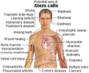 Det forskes mye rundt om i verden på hvilke sykdommer stamceller kan hjelpe mot.